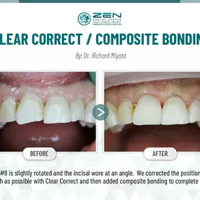 Zen Dental Center Family, Cosmetic, Implants -  Call: 206-324-1100 | Location: 310 Harvard Ave, Unit E Seattle, Washington 98102