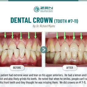 Zen Dental Center Family, Cosmetic, Implants -  Call: 206-324-1100 | Location: 310 Harvard Ave, Unit E Seattle, Washington 98102