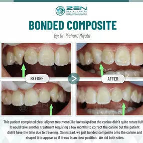 Zen Dental Center Family, Cosmetic, Implants -  Call: 206-324-1100 | Location: 310 Harvard Ave, Unit E Seattle, Washington 98102