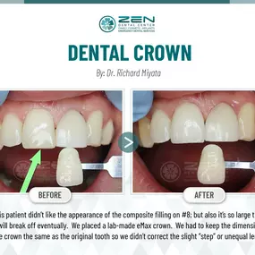 Zen Dental Center Family, Cosmetic, Implants -  Call: 206-324-1100 | Location: 310 Harvard Ave, Unit E Seattle, Washington 98102