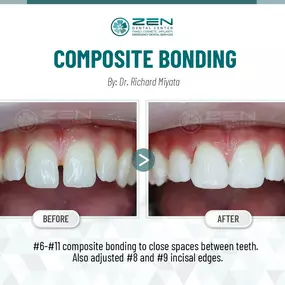 Zen Dental Center Family, Cosmetic, Implants -  Call: 206-324-1100 | Location: 310 Harvard Ave, Unit E Seattle, Washington 98102