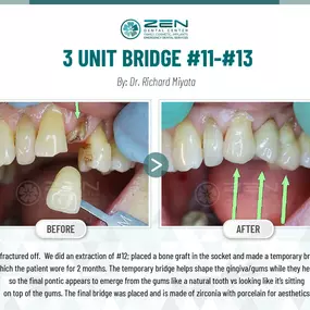 Zen Dental Center Family, Cosmetic, Implants -  Call: 206-324-1100 | Location: 310 Harvard Ave, Unit E Seattle, Washington 98102