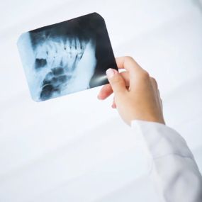 Nervous of visiting the dentist? We offer sedation dentistry to assist in an anxiety or fears your may have. To learn more about Weimar Family Dentristry, please visit our website or give us a call today!